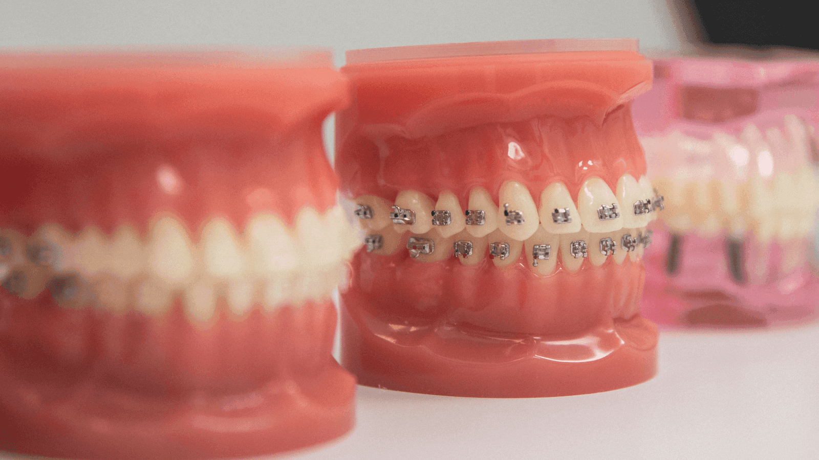 Brackets Metálicos